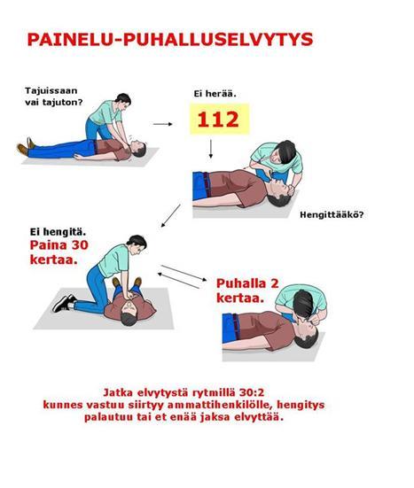 Aikuisen painelu-puhalluselvytys (Ensiapuohjeet