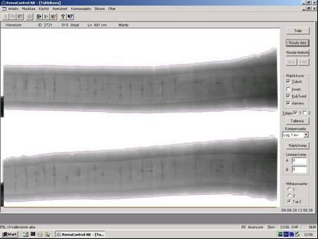 RemaLog Xray -laitteen tyvitukin läpivalaisukuva 3.