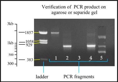 Cohenin oireyhtymää aiheuttava geeni COH1 on iso geeni: 62 eksonia; kallis Mutaatiodiagnostiikka: 2. PCR-tuote analysoidaan geelielektroforeesilla Kolehmainen ym.