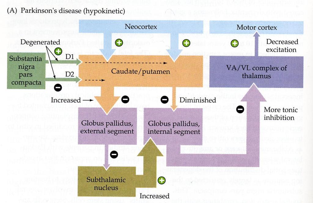 Parkinsonin