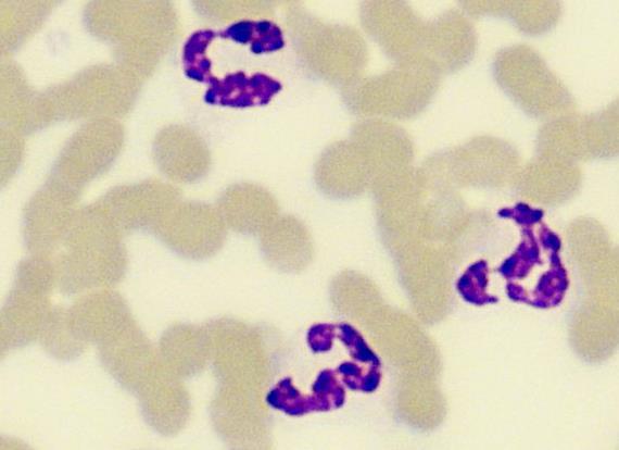 13 Ihmisillä ja muilla nisäkkäillä vasemmalle siirtymistä puolestaan tapahtuu esimerkiksi voimakkaiden tulehdusten yhteydessä, jolloin neutrofiilien varhaiset muodot (promyelosyytti, myelosyytti,