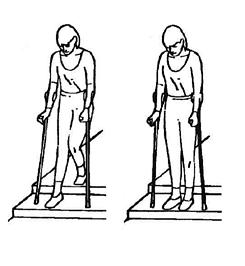 Porraskävely ylös Astu terveellä jalalla ylemmälle portaalle, ponnista. Nosta sitten leikattu jalka ja sauvat samalle portaalle.