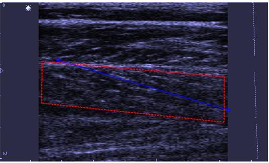 38 Jalkadynamometristä saadut signaalit kerättiin tietokoneelle AD-muuntimen kautta. (CED 1401, Cambridge Electronic Deing). Keräystaajuus oli 1 khz.