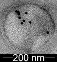 Eksosomien pintaan on leimautunut spesifisesti CAV-1 vasta-aineella, jossa kulta-atomi näkyy mustana pisteenä. B Edellistä vastaava spesifinen CD-63 vasta-aineleimaus.