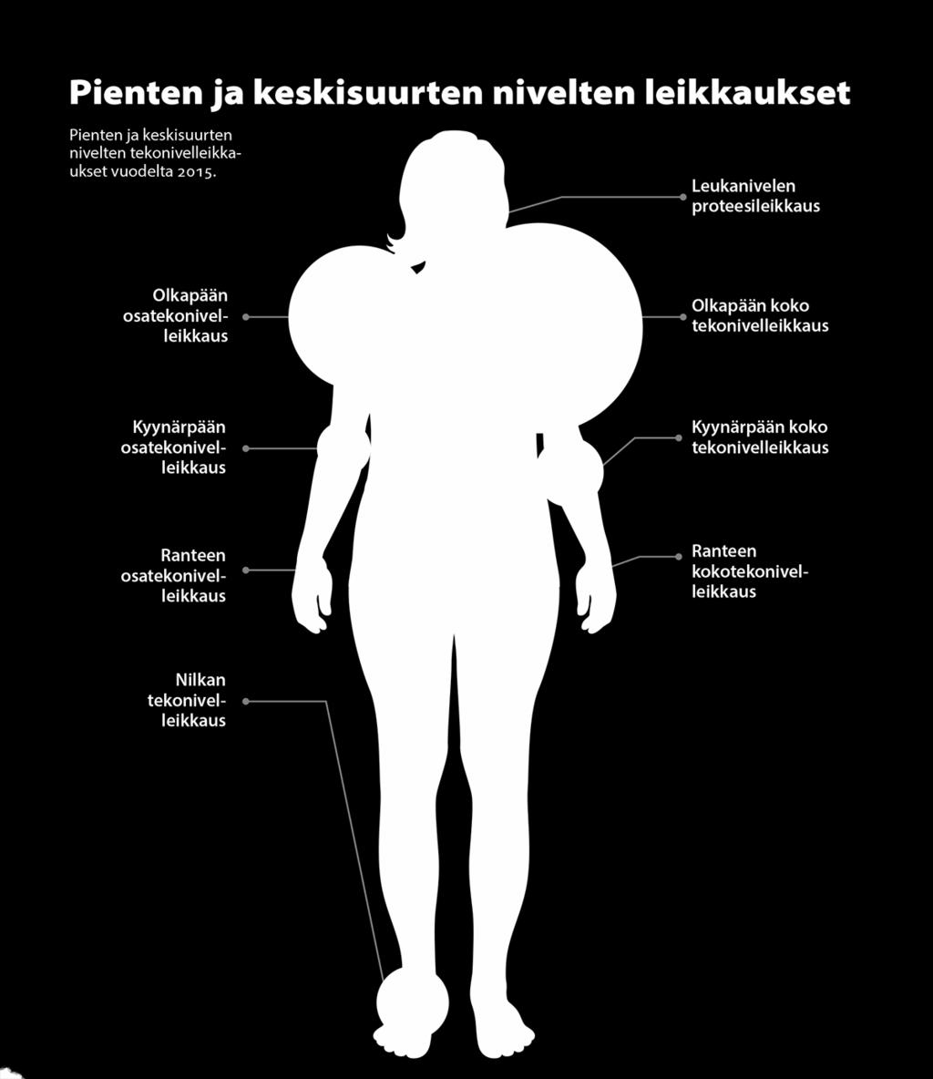 Lähde: Hoitoilmoitusjärjestelmä, Implanttirekisteri, THL Kokemus karttuu tiimityössä Tampereella leikataan 40-50 rystystekoniveltä vuodessa.