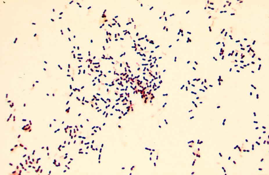 Pneumokokkirokotteet