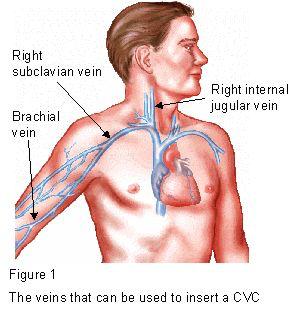 CVK