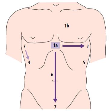 16 (44) Vatsaontelo tutkitaan viimeisenä. Selällään maatessa alueen pienemmät nestekertymät hakeutuvat anatomisesti vuotokohdan alapuolelle, lähelle vuotokohtaa.