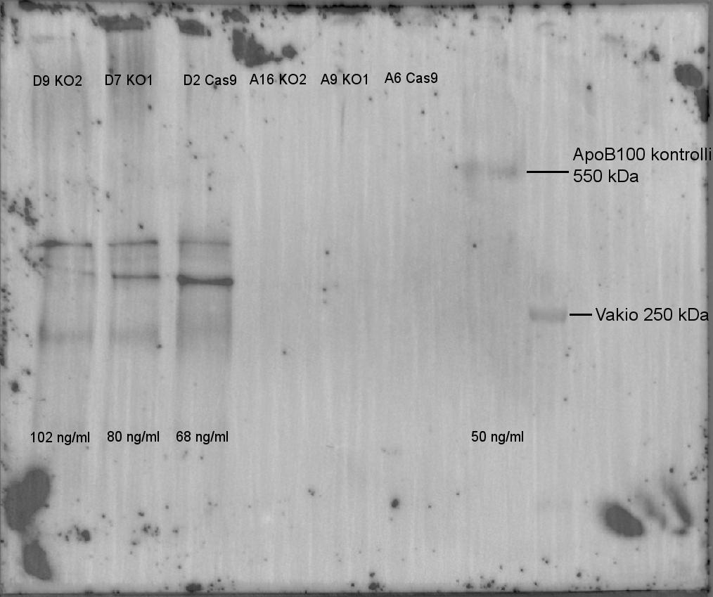 36 8.4 Western blot-analyysi ApoB-100:n Western blot -analyysi esitetty kuviossa 17 A- ja D-näytteille.