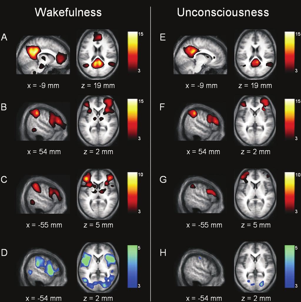 network and lateral frontoparietal cortices (D).