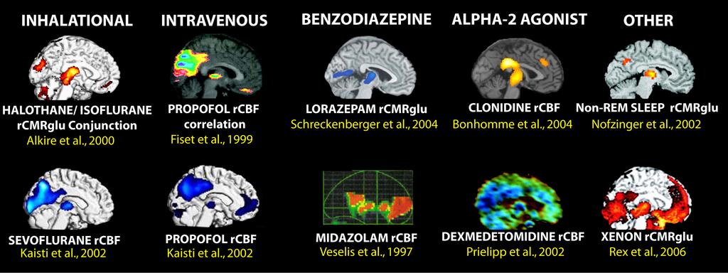 001 Långsjö et al, J Neurosci 2012 Eri anesteettien