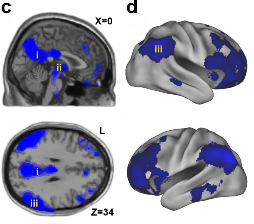 Baars et al, Trends in Neurosciences 2003 Nukahtaminen ja herääminen