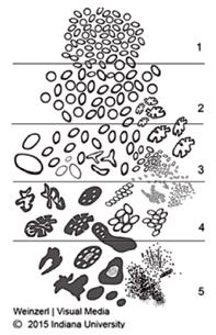 Erilaistumisryhmpisteytys Gleason- (grade group) 1 3 +3 = 6 2 3 4 5 3 + 4 = 7 4 + 3 = 7 4 + 4 = 8 3 + 5 = 8 5 + 3 = 8 9 10 Histologiset kriteerit Pelkästään hyvin erilaistuneita rauhasrakenteita