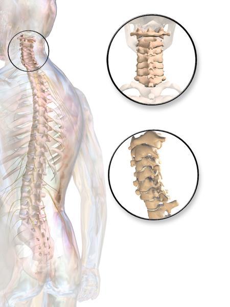 11 Kuvio 2 Kaularanka (Cervical Spine 2013) Kaulanikama koostuu nikamarungosta ja nikamakaaresta (Middleditch & Oliver, 2005, 15).
