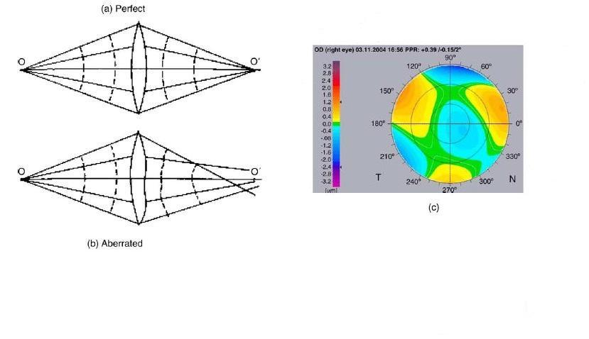 4 Pisteiden hajautusfunktio saadaan laskettua, jos aberraatio on tiedossa. Tämän tyyppisiä laskelmia varten, voidaan käyttää kaupallisia aberrometrejä mittaaman tietyn silmän aaltorintaman poikkeamaa.