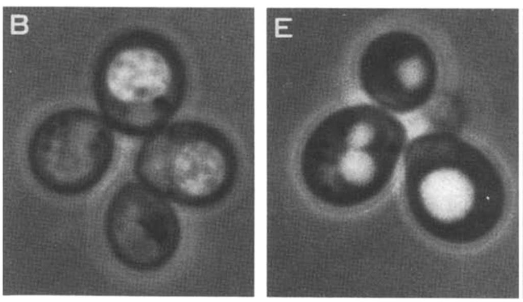Ohsumi seuloi hiivamutantteja, joiden lysosomeihin ei kertynyt autofagisia rakenteita typpipaaston aikana Nomaali hiiva Mutanttihiiva - Seulonnassa löydettiin 15