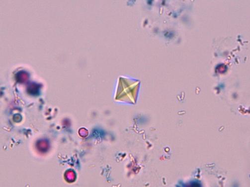 eläinlaji, virtsan väkevyys ja sen säilytys. Emäksisessä virtsassa saostuvat muun muassa struviitti eli ammonium-magnesium-fosfaatti, kalsiumfosfaatti ja kalsiumkarbonaatti.