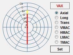 16.13 Koettimen asennon valinta Position map -toiminnon avulla on helppo taltioida koettimen asento yhdessä tallennetun B-Scan-kuvan tai -videon kanssa.