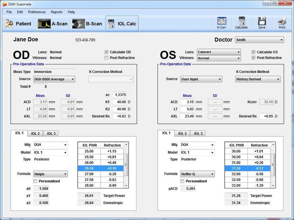 17 IOL Calculator -näkymä IOL Calculator -näkymässä käyttäjä voi suorittaa ja tarkastella valittuna olevan potilaan intraokulaarilinssin