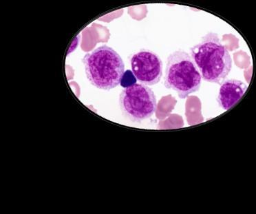 Selective DSS  Vinblastine Danusertib Vinorelbine YM155 Mitoxantrone Camptothecin PF-00477736 Clofarabine Idarubicin %