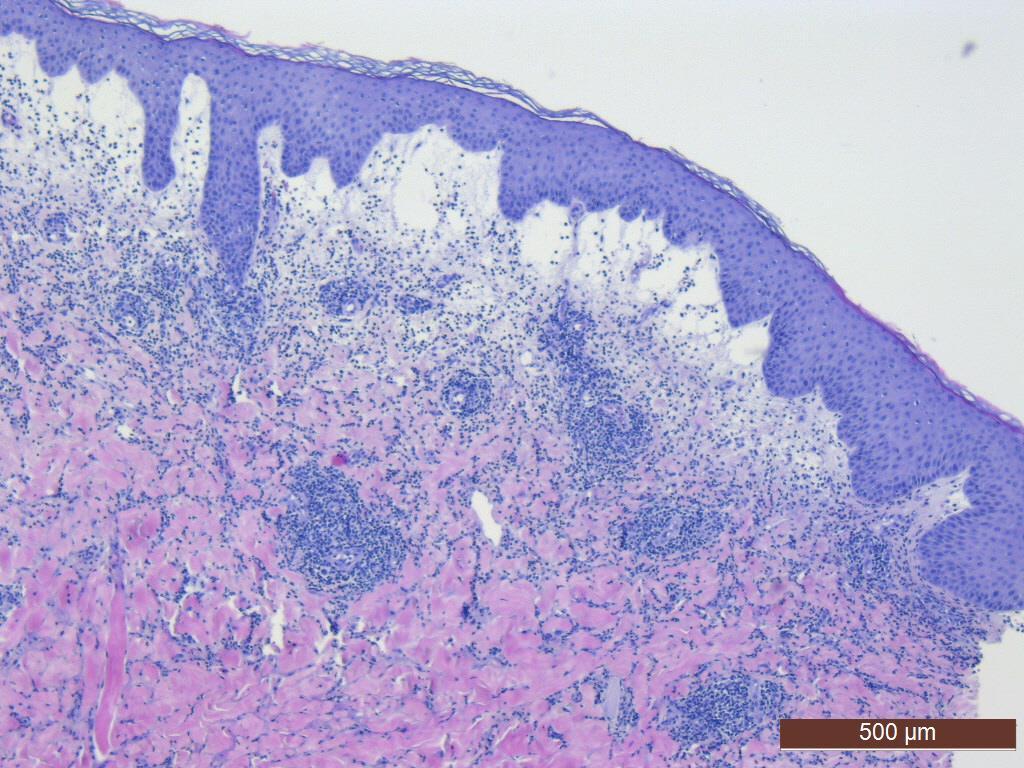 HISTOLOGY