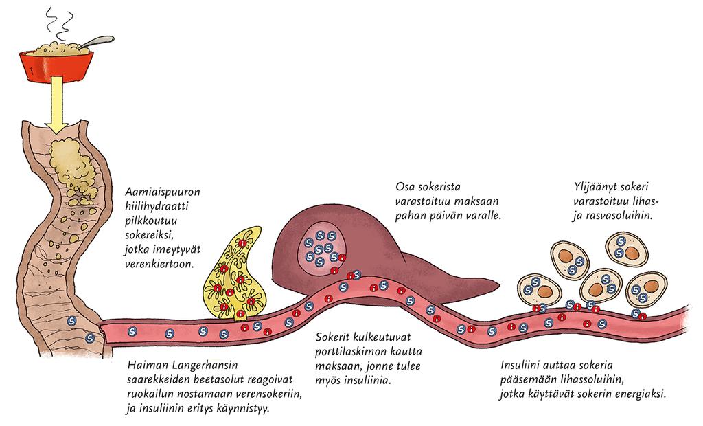 7 (76) 2 TYYPIN 2 DIABETES SAIRAUTENA Diabetes on elimistön tila, jossa veren glukoosipitoisuus on pysyvästi 7,0 mmol/l tai sen yli paastosta huolimatta.