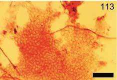 (A) Polyfosfaatin (vihertävänkeltainen) fluoresenssivärjäys