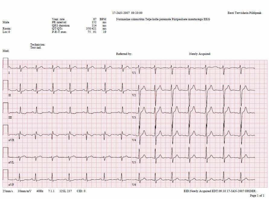 EKG visualiseerimine Pildipangas Pildipanga