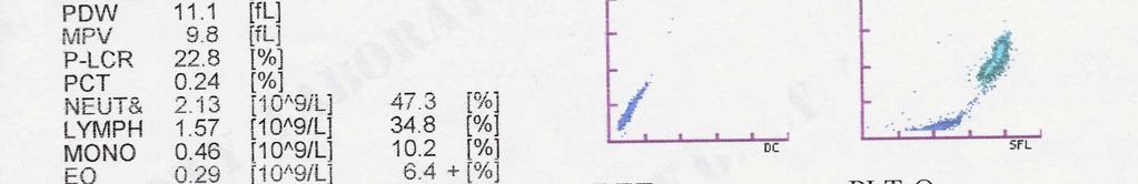 miehet 134-167 g/l B-Hkr naiset 35-46 %,