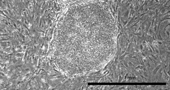 Kuva 2. Esimerkki soluviljelykuopassa kasvavasta ips-solujen koloniasta. Tässä kuvassa ips-solut kasvavat tukisoluina toimivien hiiren alkion fibroblastien (MEF, mouse enbryonic fibroblasts) päällä.
