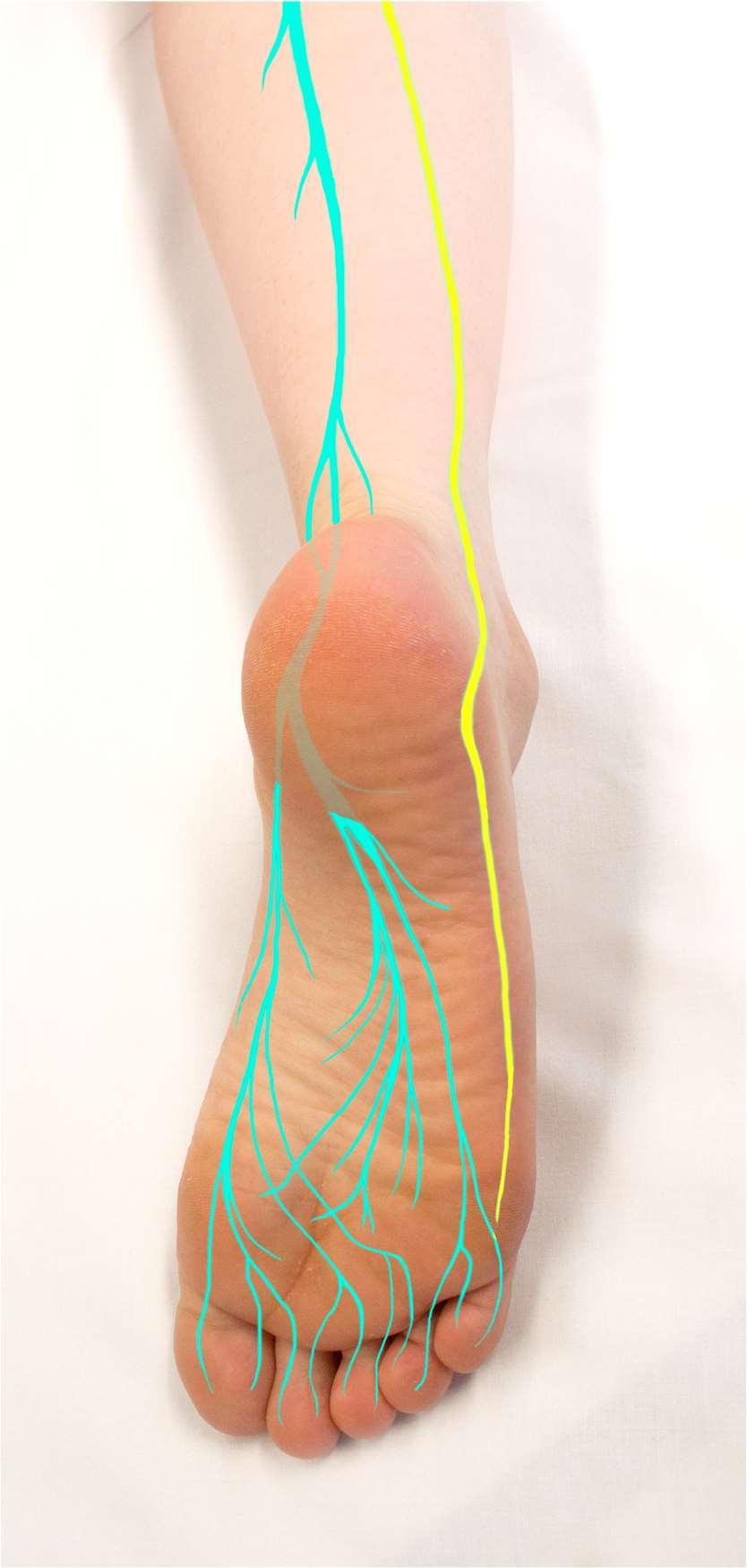 tibialis) ja yhteinen pohjehermo (n.