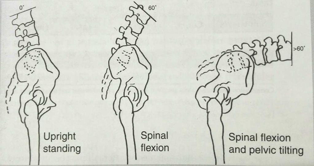 Pystyasento Selkärangan koukistus Selkärangan koukistus ja lantion kallistus Kuva 11.