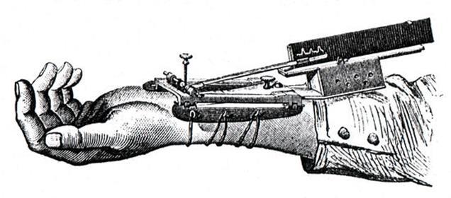 KUVA 3 Étienne-Jules Mareyn Sphygmograph eli verenpainemittari, 1860.
