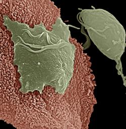 Trichomonas vaginalis (trikka) Alkueläimiin kuuluva siimaeläin T. vaginalis Samaan sukuun kuuluu suussa elävä T. tenax Ei muodosta kystaa, vaan on aina ns.