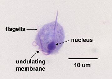 Trichomonas - morfologia Axostyle-tukirakenne Flagella Tuma Aaltoileva kalvo