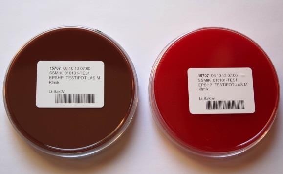 Ohje ja versio: Näytteenottovälineet-10 Sivu 3/17 Li-BaktVi (1154) Bakteeri, viljely likvorista (Tutkimukseen kuuluu myös bakteerivärjäys) Li-MenNhO (8879) Meningiitti,