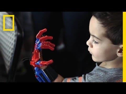 3D printed prosthetics