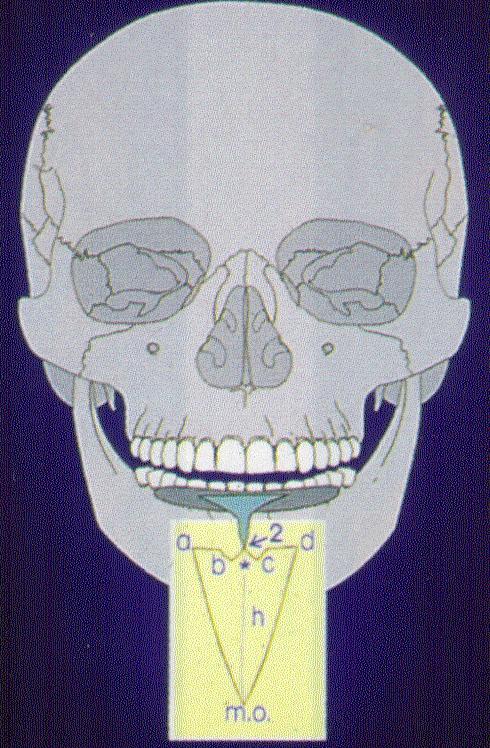 Sagittal