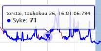 Näin mittaus jakautuu tyypillisessä kolmen vuorokauden mittauksessa noin vuorokauden mittaisiin osiin.