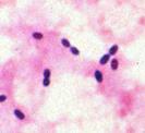 anaerobinen kokki Streptococcus pneumoniae Beetahemolyyttiset streptokokit Streptococus viridans En