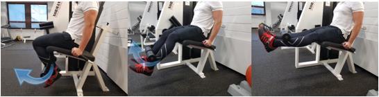 22 Erotusdiagnostisesti proksimaalisessa hamstring-tendinopatiassa on tärkeää tutkia mahdolliset tuber ischiadicumin bursiittien aiheuttamat oireet.