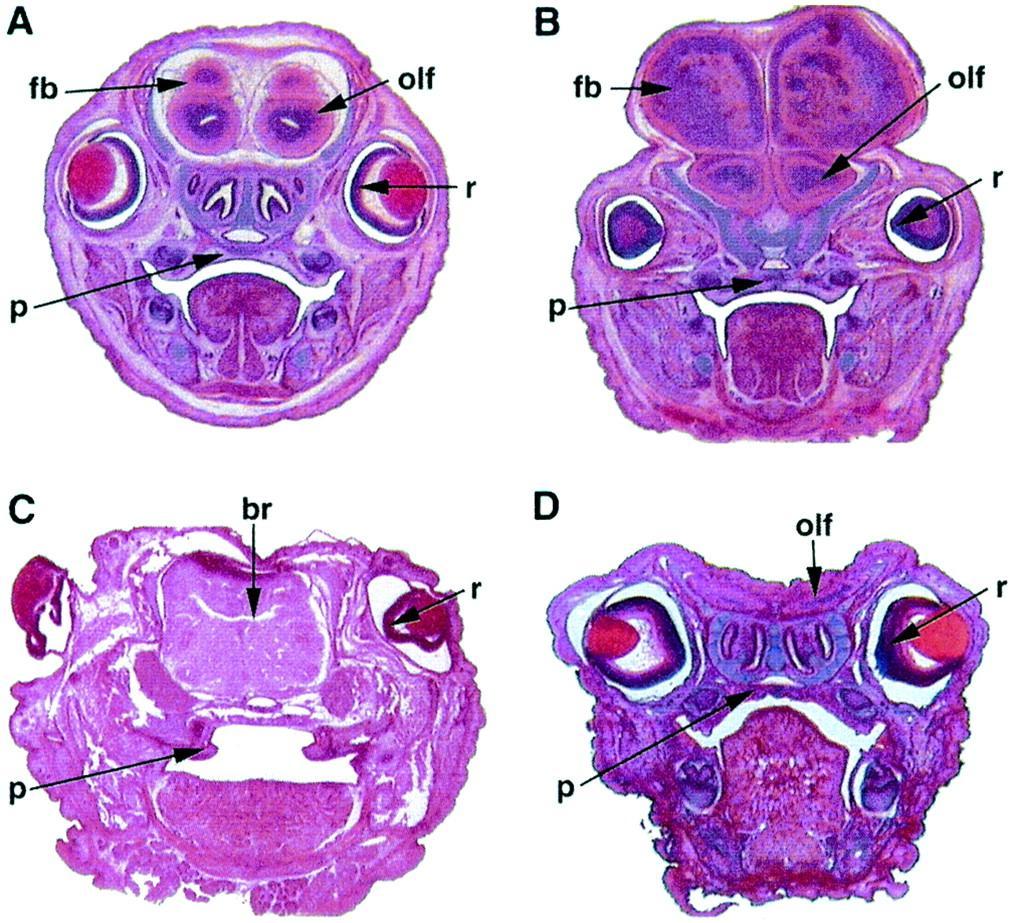 Phenotypic variation in Apaf-1-deficient newborns closely resembles that seen in fog embryos.