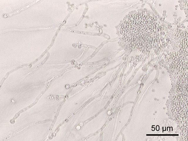 SIENET Luennon tavoitteet tarjota hammaslääketieteen opiskelijalle tiivistettynä yleisen mykologian perusteita Pentti Kuusela dosentti, vt ylilääkäri HUSLAB/kliininen mikrobiologia Bakteriologia &