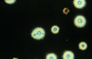 dermatofyyteistä ja rihmasienistä) sienten aiheuttamista infektioista (muistakin kuin suuontelon infektioista) sieni-infektioiden hoitoon käytetyistä lääkkeistä Sienten jaottelu Sieninäyte Sienten