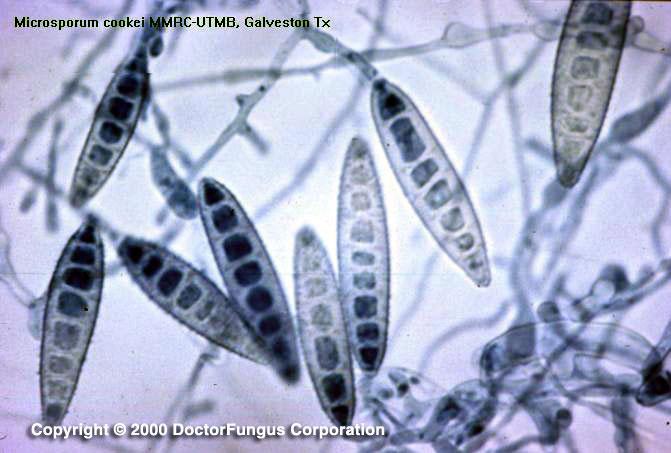 Identifikaatiorakenteita Sienten tutkiminen-4 Serologiset testit Microsporum canis