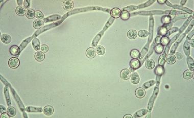 seuranta Candida, Cryptococcus, Histoplasma immunopuutteiset reagoivat huonosti