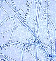 näytteitä hinta Sienten tutkiminen-5 Sienten tutkiminen-6 Histopatologia