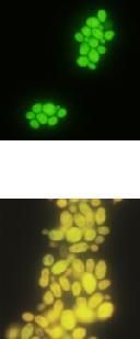 multiplex-pcr real-rime PCR panfungal PCR sienimäärän kvantitointi Massaspektometria