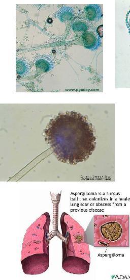 omalta iholta (varvasväli) T. rubrum T. mentagrophytes E.
