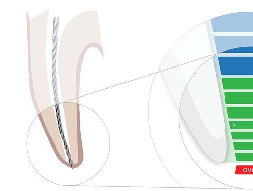 Vaihekohtaiset ohjeet 6.10 Työskentelypituuden määrittäminen 6.10.1 Määritys Anatomian termit on määritetty seuraavasti: Nro.